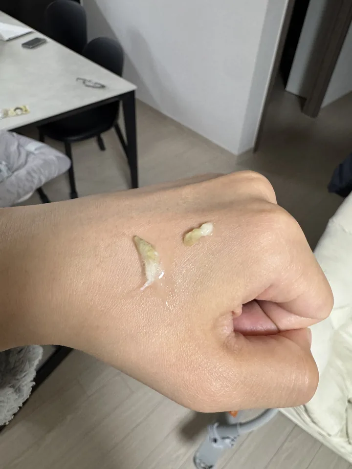 아기 코에서 빼낸 큰 코딱지를 손등에 올린 인증샷